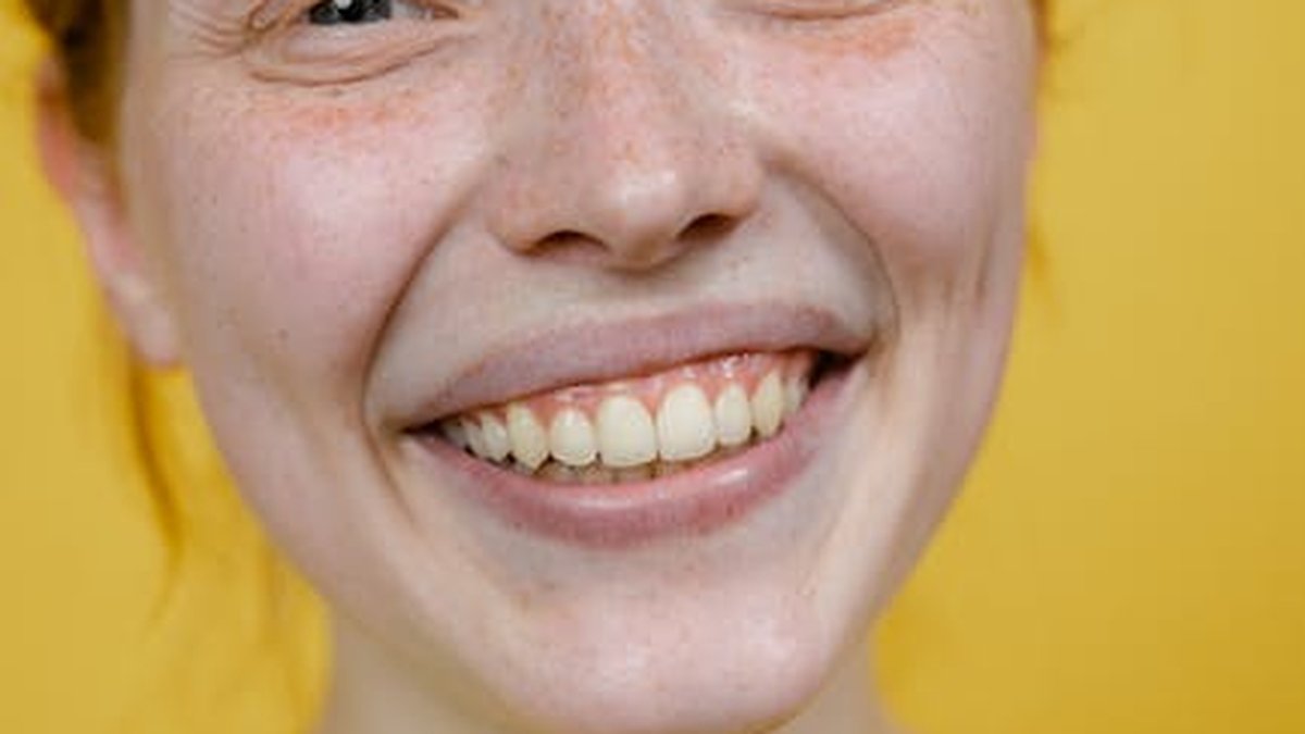 Why Yellow Teeth Don’t Always Mean Bad Oral Health